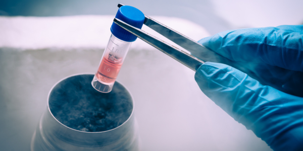 Cryopreservation process in Navi Mumbai at Sattva Fertility Care Center