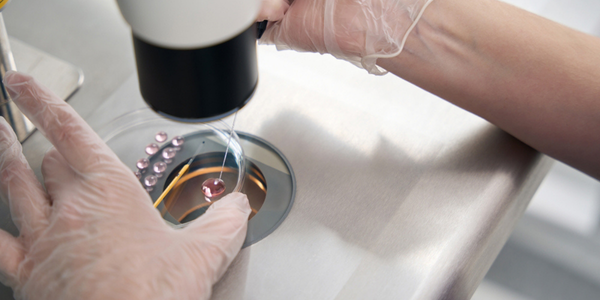 Embryo culture process in Navi Mumbai at Sattva Fertility Care Center