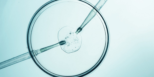 Embryo transfer procedure in Navi Mumbai at Sattva Fertility Care Center