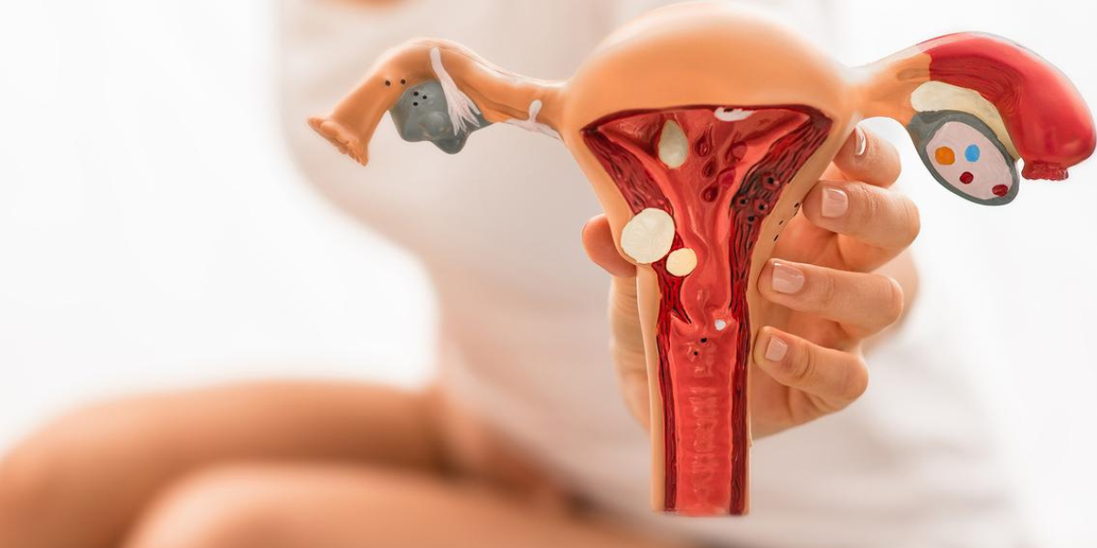 Endometriosis diagnosis and treatment consultation in Navi Mumbai at Sattva Fertility Care Center