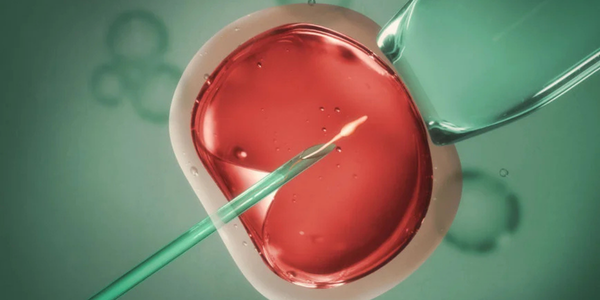 Fertilization process in Navi Mumbai at Sattva Fertility Care Center