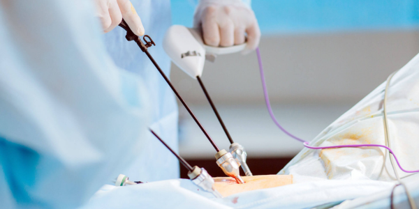 Laparoscopy surgery consultation in Navi Mumbai at Sattva Fertility Care Center