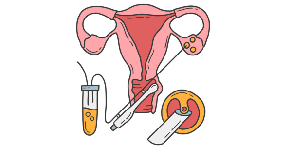 Risk minimization in fertility treatment in Navi Mumbai at Sattva Fertility Care Center