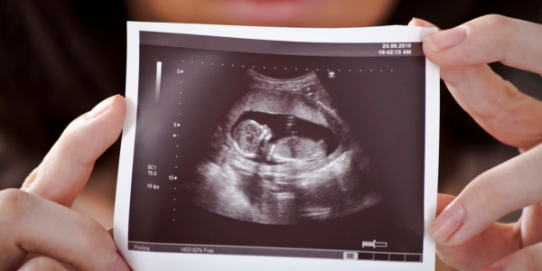 Real-time imaging ultrasonography in Navi Mumbai at Sattva Fertility Care Center