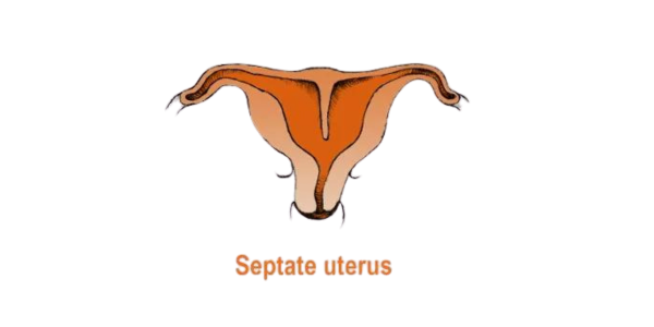 Recurrent miscarriages treatment in Navi Mumbai at Sattva Fertility Care Center