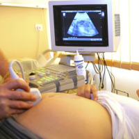 Ultrasonography at Sattva Fertlity Care Center